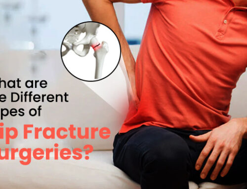 What are the Different Types of Hip Fracture Surgeries?