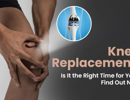 Knee Replacement: Is It the Right Time for You? Find Out Now