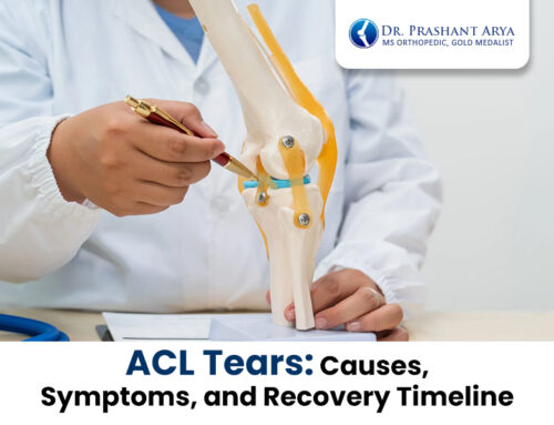 ACL Tears: Causes, Symptoms, and Recovery Timeline
