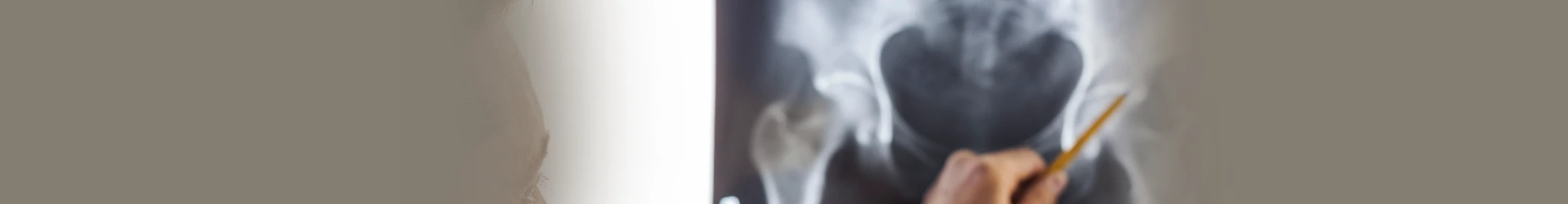 Hip Fracture Treatment in Jamshedpur