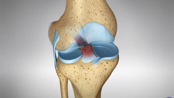 orthopedic surgeon in Jamshedpur