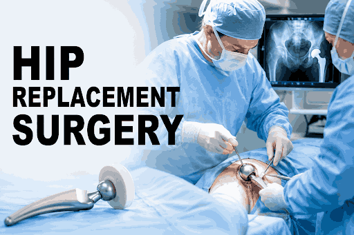 Hip replacement surgery being performed by orthopedic surgeons in operating room