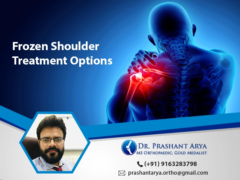 Frozen Shoulder Treatment Options