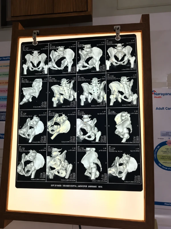 X-Ray Report X-Ray Report